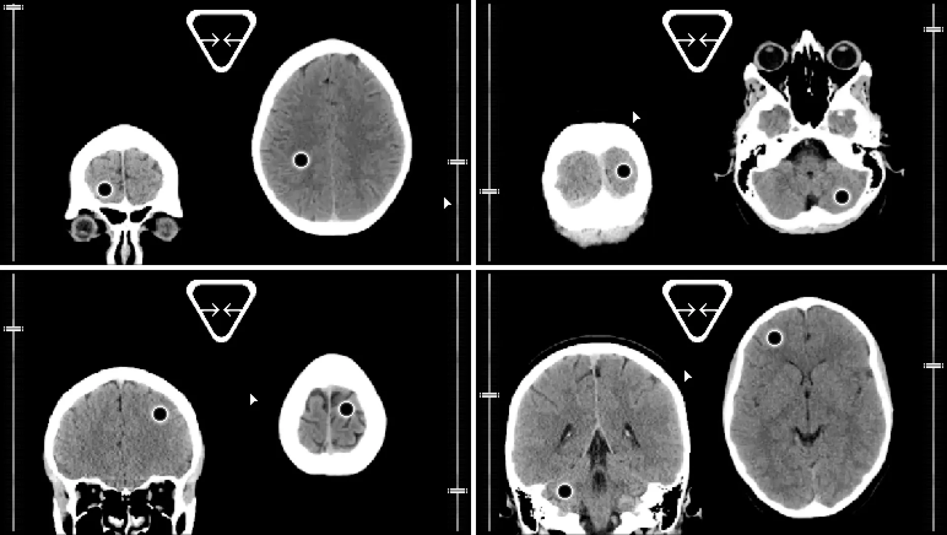 Four skull scans with selectable black holes